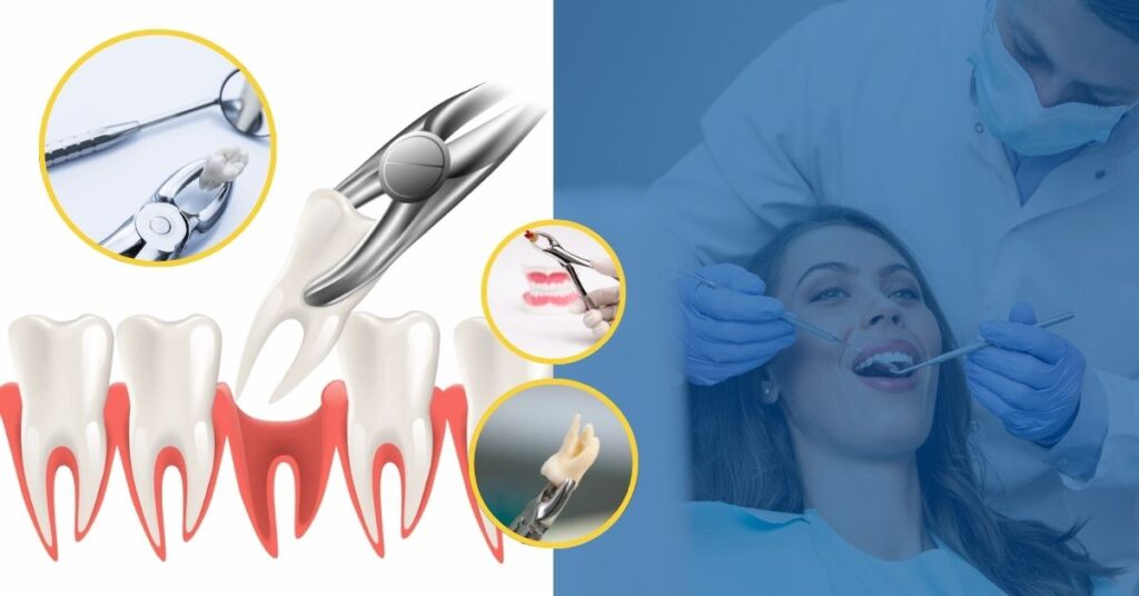Diagram of tooth anatomy highlighting nerve damage
