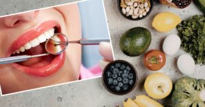 National Nutrition Month- The Link Between Diet and Dental Health