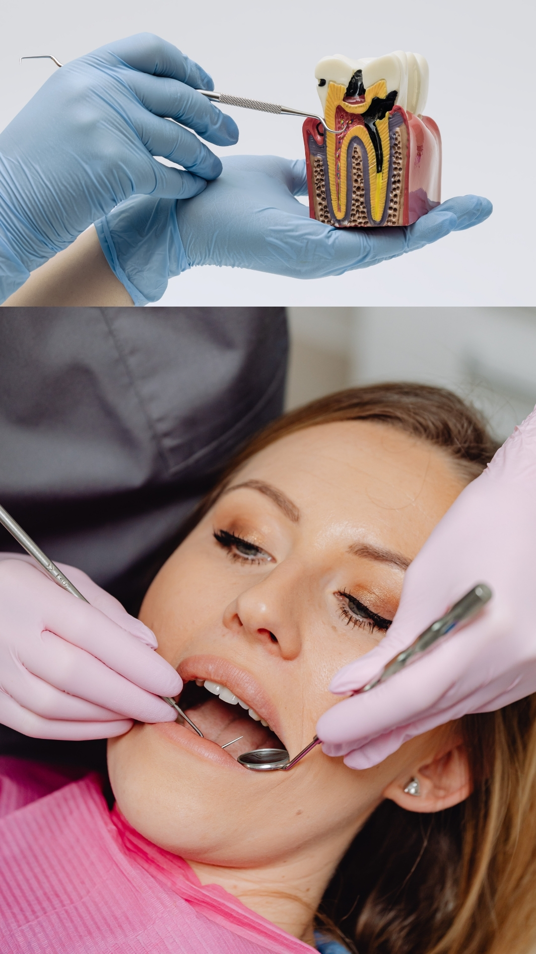 Endodontics (Root Canal Treatment – RCT)