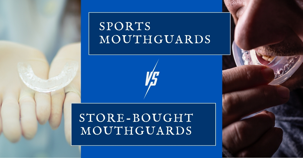 Mouthguards vs. Store-Bought