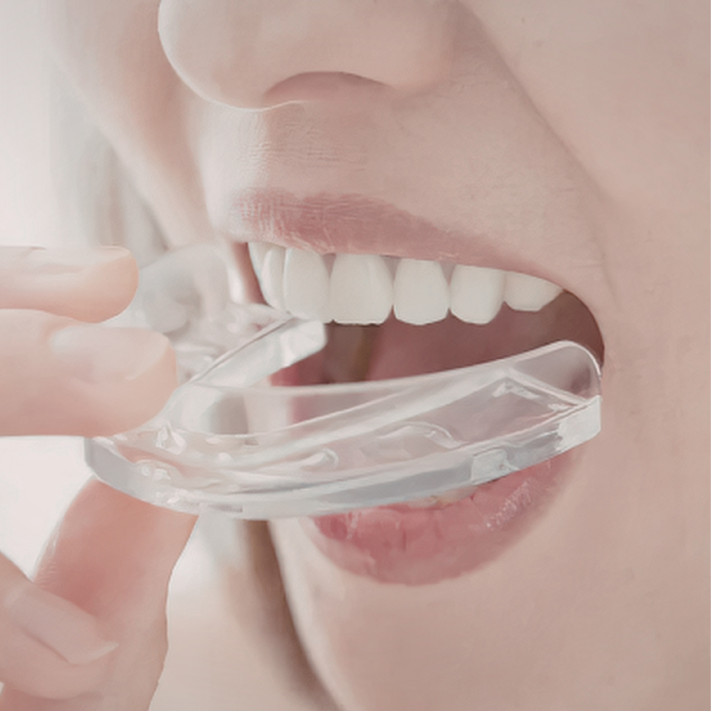 SPORTS THAT MAY REQUIRE DENTAL PROTECTION