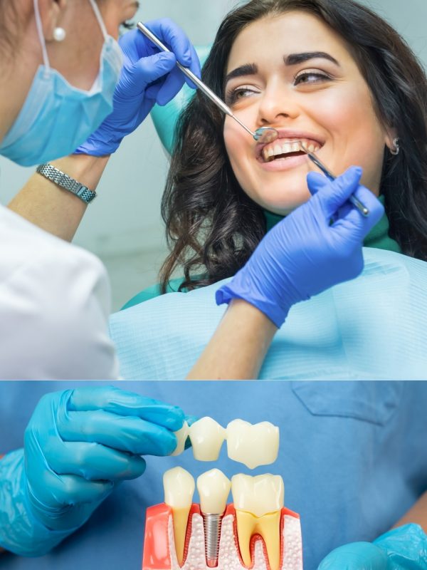 Endodontics (Root Canal Treatment – RCT)