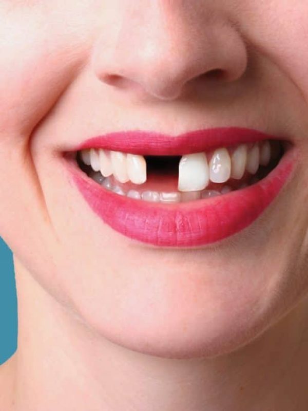 Cosmetic & Restorative Treatment