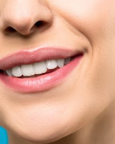 invisalign-teeth Invisalign